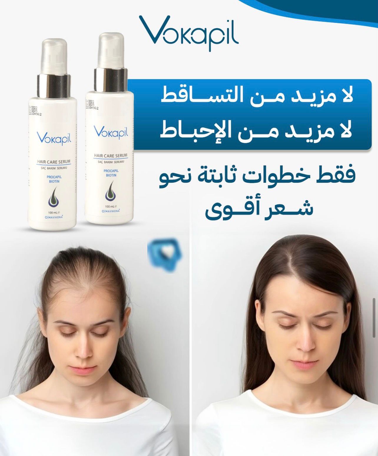 فوكابيل: علاج فعال لمنع تساقط الشعر وتعزيز نموه